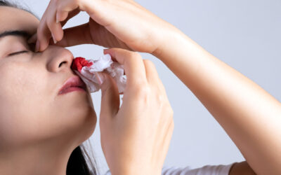 Sangrado nasal (epistaxis)